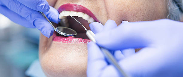 Best Emergency Dental Care for Broken or Chipped Teeth in Muscatine, IA